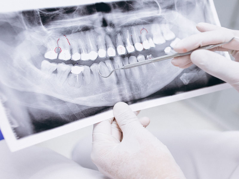  #คลินิกทันตกรรมเอพลัส #เฉพาะทางเด็ก #ทำฟันเด็ก #ทำฟันนครนายก #invisalign #จัดฟันใส #damon
